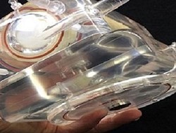 Φορητός τεχνητός «πνεύμονας» που μεταφέρεται σε σακίδιο πλάτης